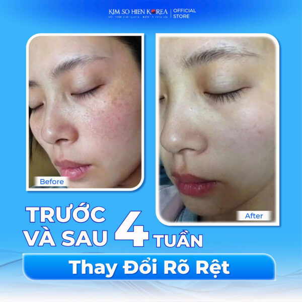 Serum Dưỡng Trắng Da,Hỗ trợ tái tạo tế bào da 50ml - Ảnh 6