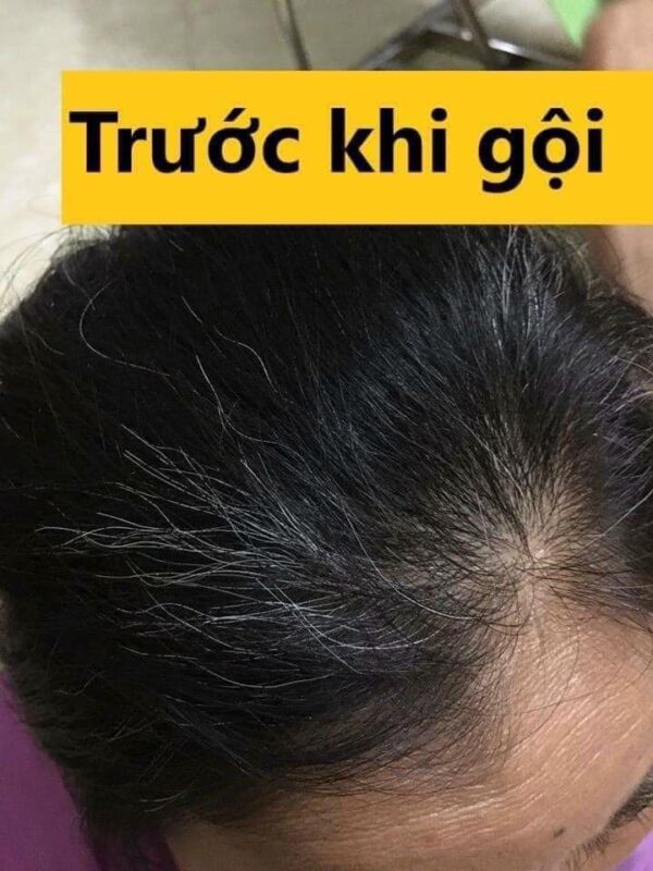 Dầu gội đen tóc thảo dược Beauty Star - Hàn Quốc Black Shampoo - Ảnh 2
