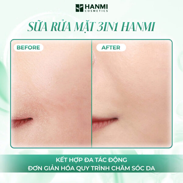 Sửa rửa mặt 3 in 1 hami - Ảnh 3